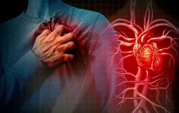 Expert Heart Failure Doctors in Delhi: Comprehensive Care for Cardiac Health