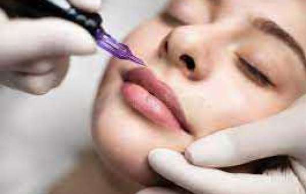 Lip Pigmentation Treatment by ReNew U sector 142,Noida 