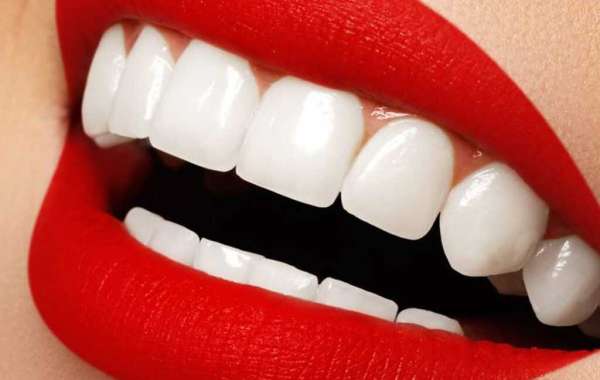 Dental Clinic Teeth Cleaning Price in Dubai
