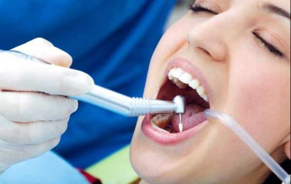 Get Dental Wellness with Tooth Scaling and Root Planing