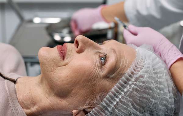 Botox and Profhilo: Two Powerful Tools in the World of Non-Surgical Anti-Aging Treatments