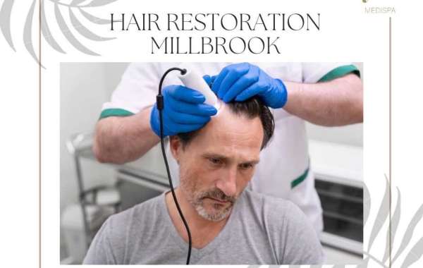 A Holistic Journey to Wellness: Combining Acupuncture in Millbrook, NY with Hair Restoration at Tyte Medical Spa