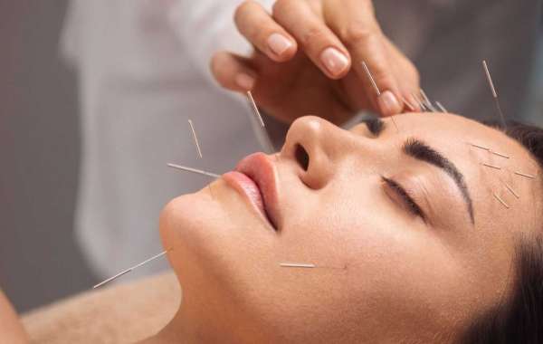 Acupuncture Therapy for Weight Loss: Shed Pounds Naturally