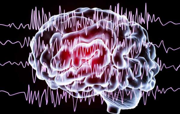 Epilepsy: Comprehending the Electrical Storms in the Brain